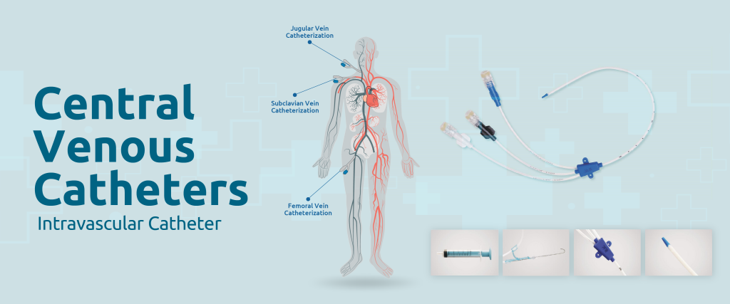 Central Venous Catheters - Arvensis